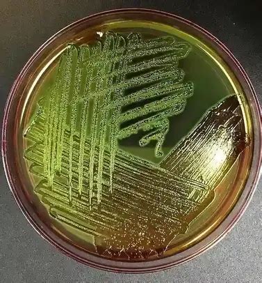 1.28: EMB Agar .